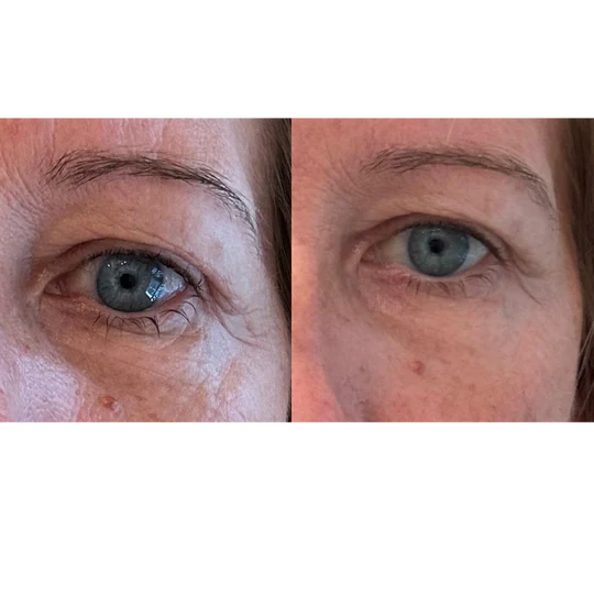 Maya Chia The Advanced Eye Response Complex Retinol Cream