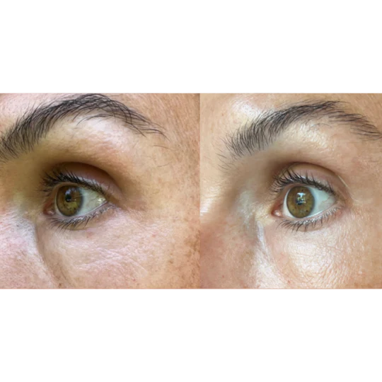 Maya Chia The Advanced Eye Response Complex Retinol Cream