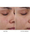 Westman Atelier Pore Refining Complex Serum