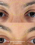 Leaf Dermaplaner