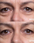 Wrinkles Schminkles Eye Wrinkle Patches
