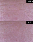 PATYKA Advanced Plumping Serum
