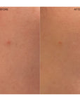 Ogee Clearganics Targeted Blemish Treatment