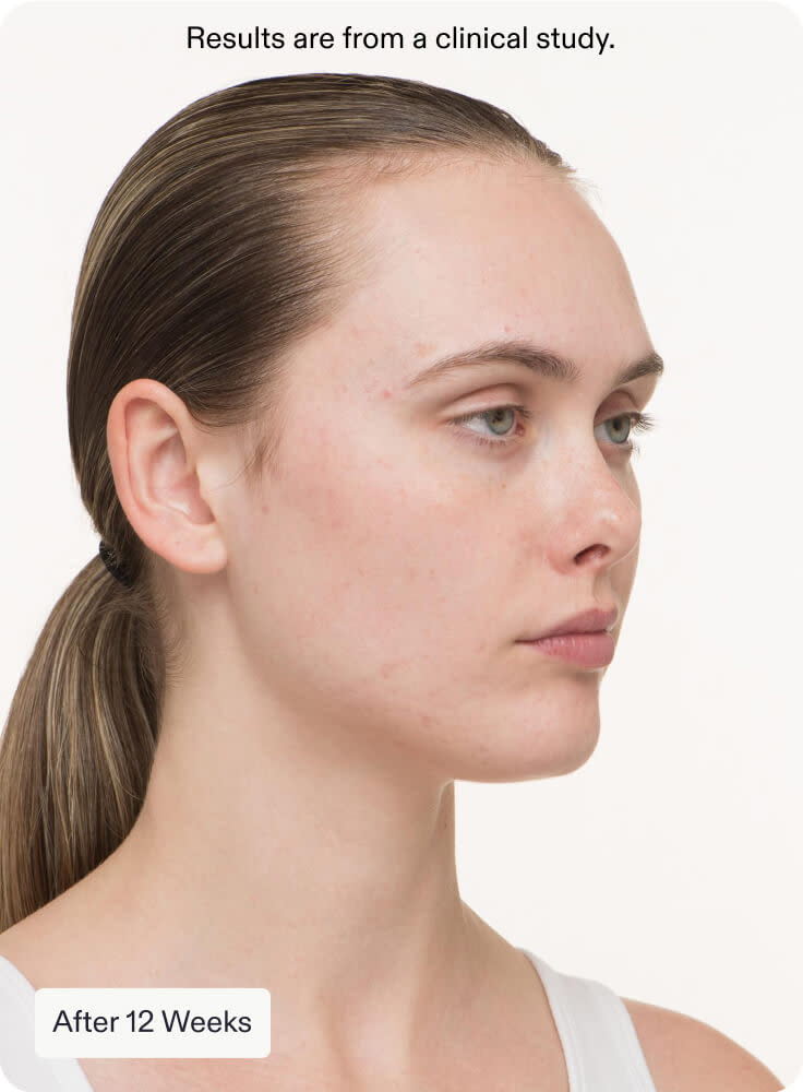 Nutrafol Skin Clear Skin Pack (3 month supply)