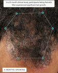 Nutrafol Men Hair Growth Pack (3 month supply)