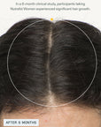 Nutrafol Women's Vegan Hair Growth Pack (3 month supply)