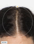 Nutrafol Women's Vegan Hair Growth Pack (3 month supply)