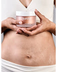 SoKind Love Lines Stretch Mark Balm
