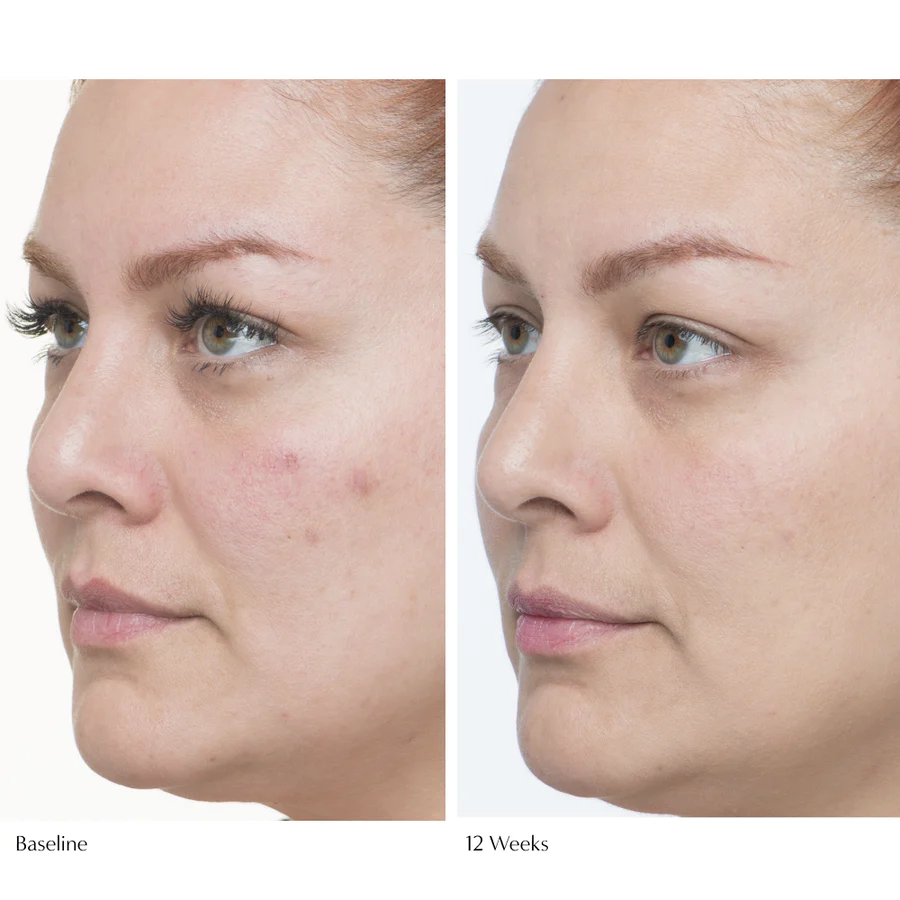 Le Prunier Plumscreen® Broad Spectrum SPF 31 PA+++