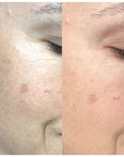 Maya Chia The Straight A Advanced Gentle Retinol Treatment