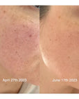 Maya Chia The Advanced Response Complex Face | Neck Cream