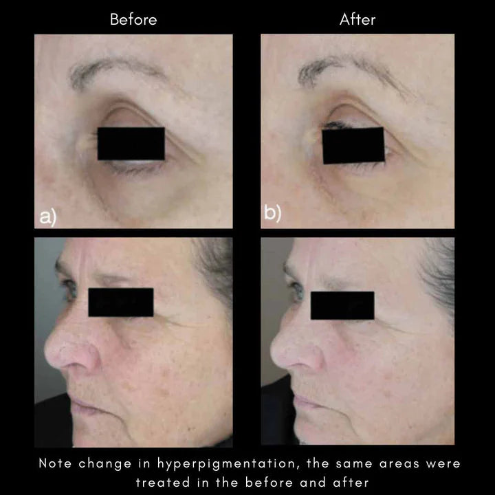 Maya Chia The Advanced Response Complex Face | Neck Cream Refill
