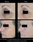 Maya Chia The Advanced Response Complex Face | Neck Cream Refill