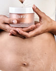 SoKind Love Lines Stretch Mark Balm