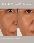 OGEE Brightening Toner BHA 2%