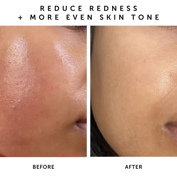 Herbivore Nova 15% Vitamin C + Turmeric Brightening Serum