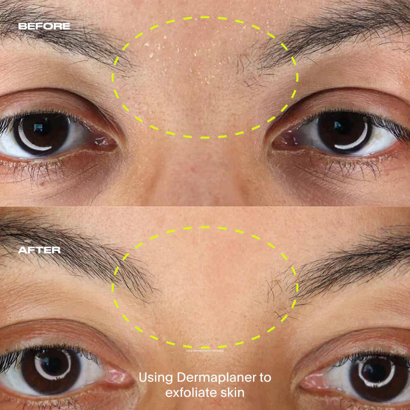 Leaf Dermaplaner Kit
