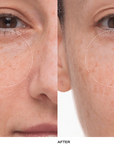 Le Prunier Plumtox™ Clarifying Enzyme Mask