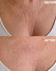 Wrinkles Schminkles Chest Wrinkle Patch