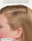 Nutrafol Women's Balance Hair Growth Pack