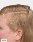 Nutrafol Women's Balance Hair Growth Pack