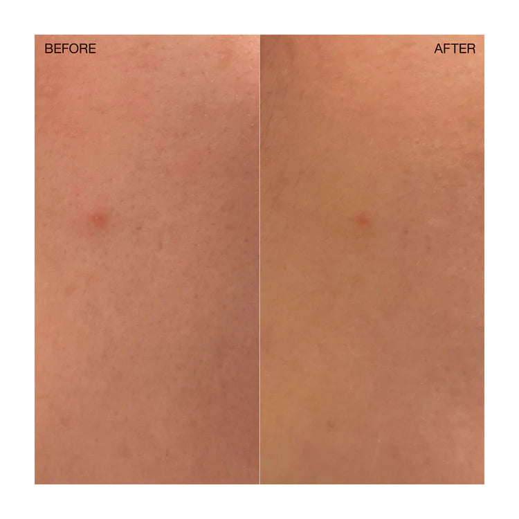 Ogee Clearganics Targeted Blemish Treatment