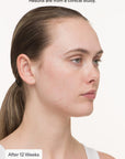 Nutrafol Skin Clear Skin Pack (3 month supply)