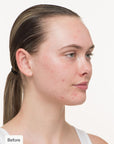 Nutrafol Skin Clear Skin Pack (3 month supply)
