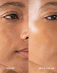Furtuna Triple Active Exfoliator