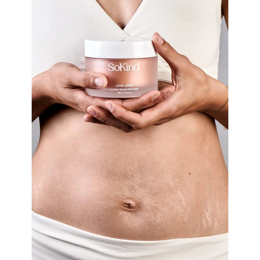 SoKind Love Lines Stretch Mark Balm