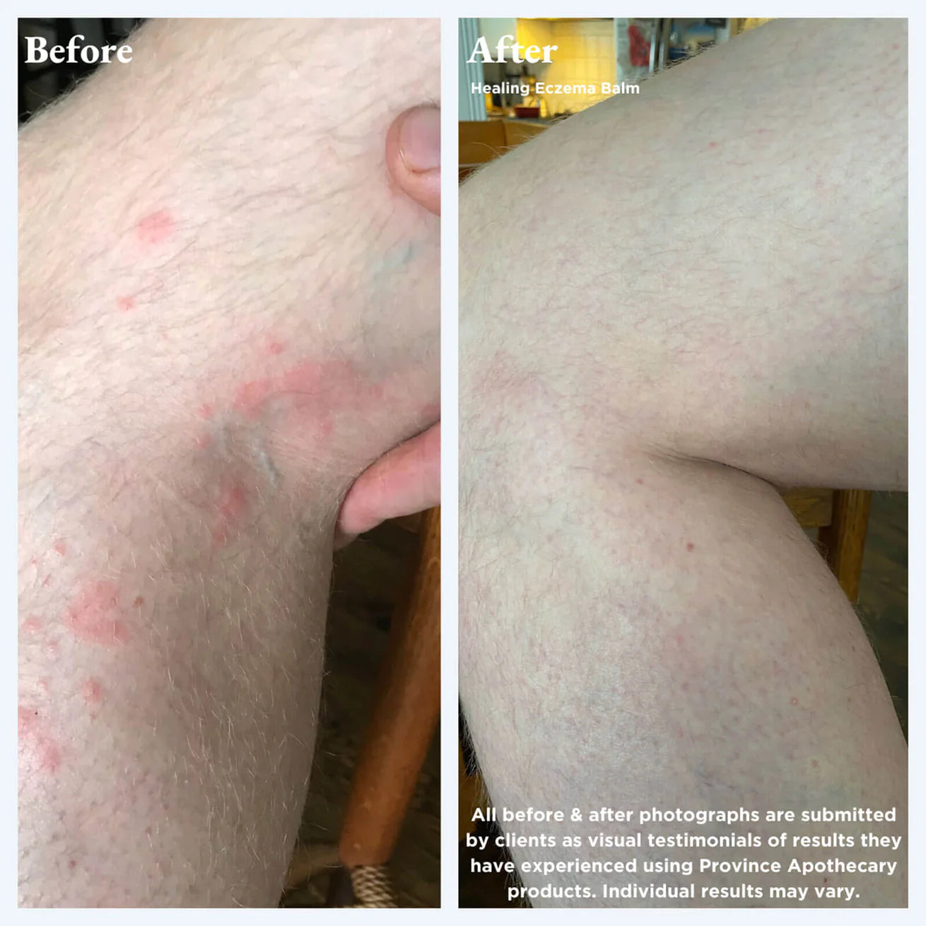Province Apothecary Healing Eczema Balm
