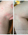 Province Apothecary Healing Eczema Balm
