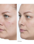 Le Prunier Plumscreen® Broad Spectrum SPF 31 PA+++