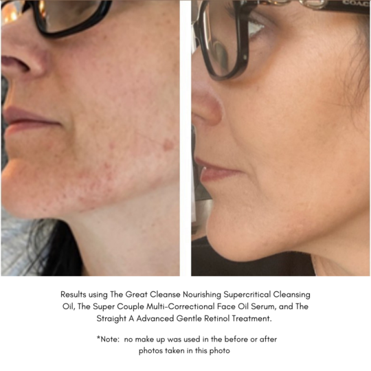 Maya Chia The Super Couple Astaxanthin + Chia Multi-Correctional Face Oil Serum