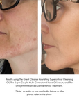 Maya Chia The Super Couple Astaxanthin + Chia Multi-Correctional Face Oil Serum